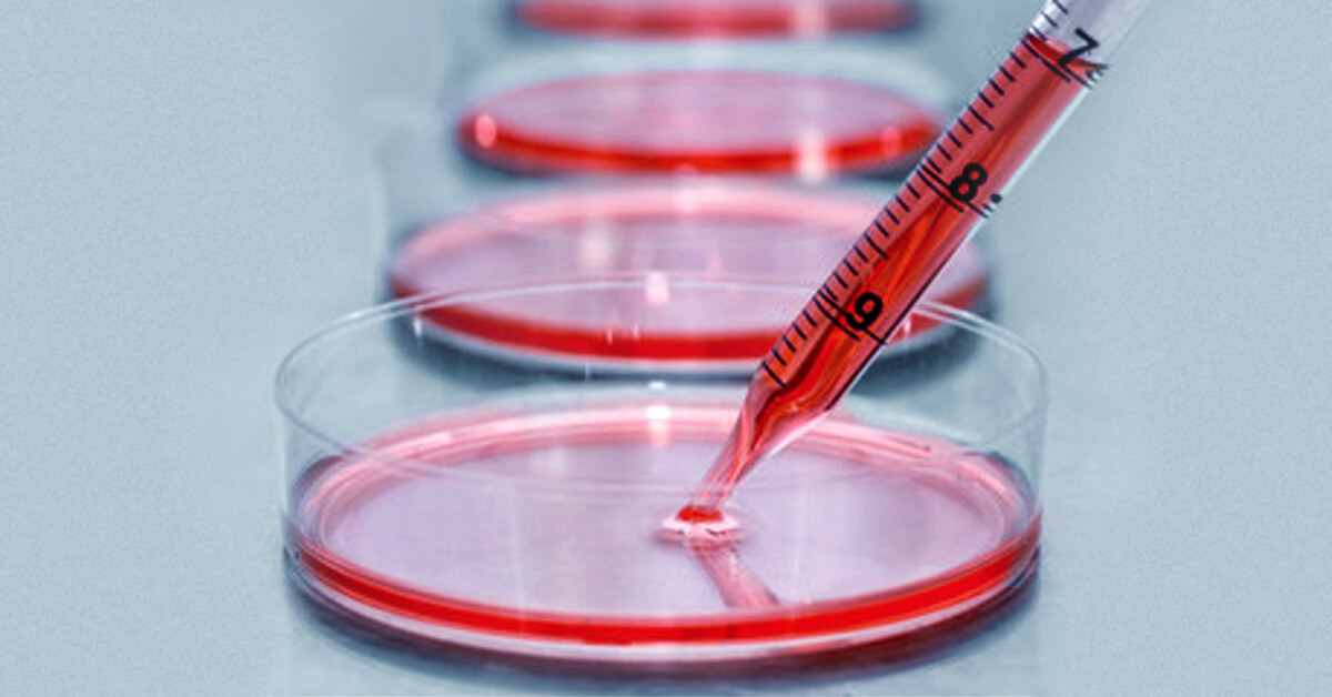 Maximizing Quality and Potency of Cell Culture Media